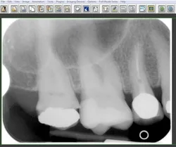 Digital dental X-ray